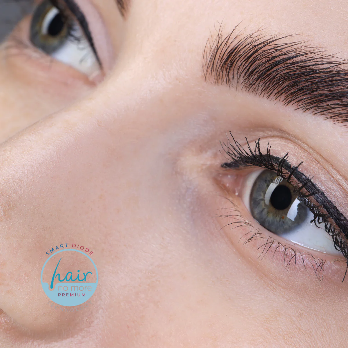 Centre Brow Laser Hair Removal - Image 2