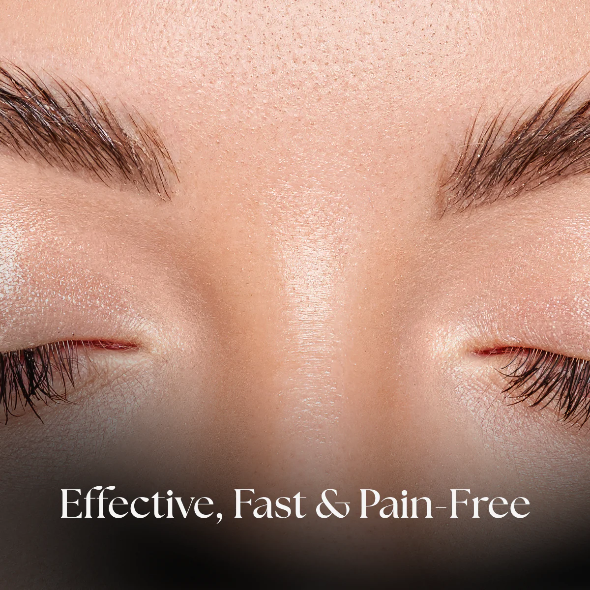Centre Brow Laser Hair Removal - Image 3