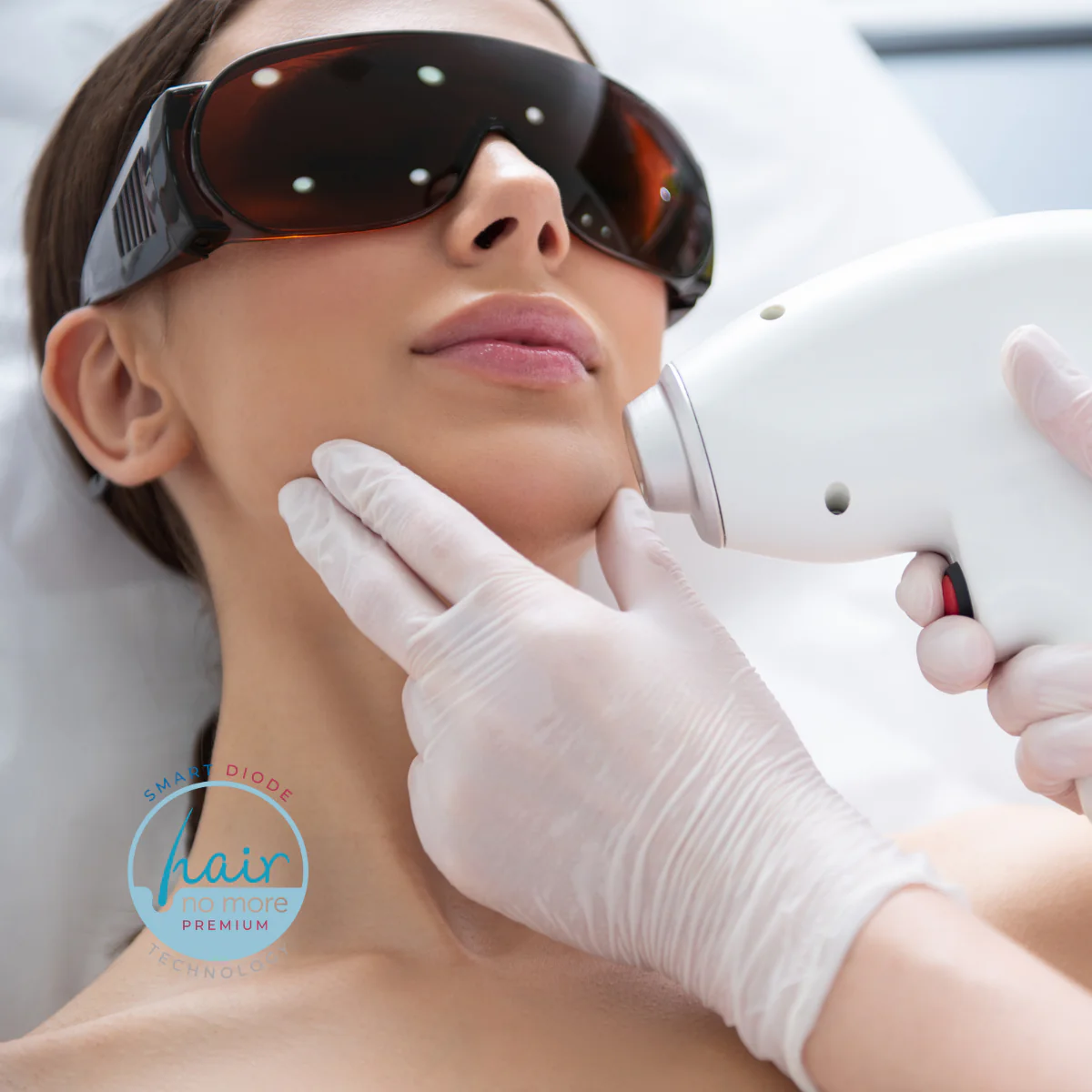 Chin Laser Hair Removal - Image 4