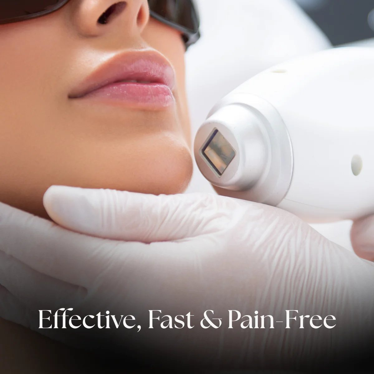 Half Face Laser Hair Removal - Image 4